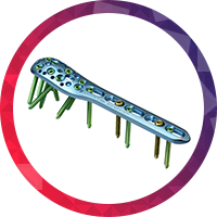 Proximal Humerus Proton Plate